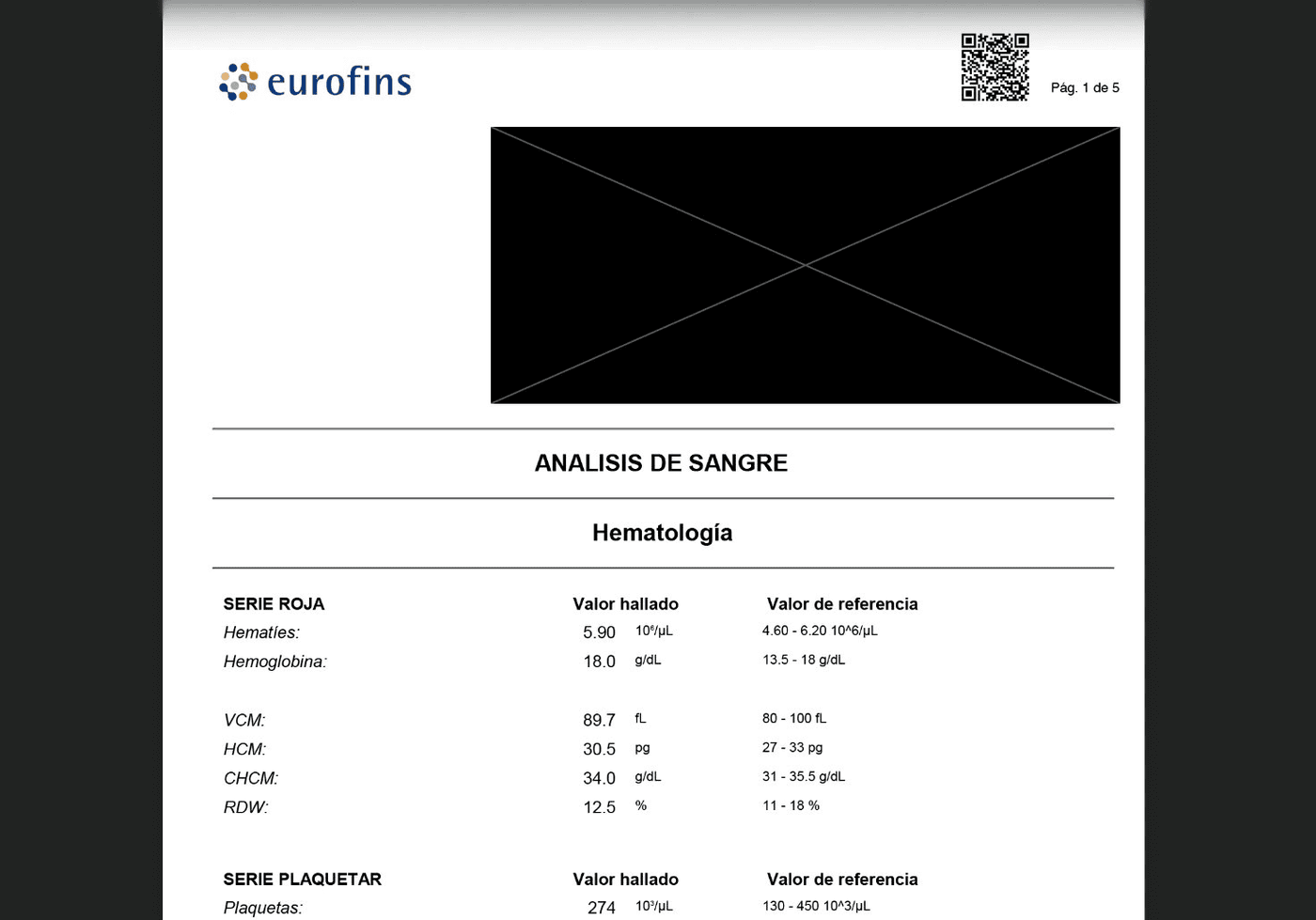 PDF con la cabecera de datos del paciente cubierta por un rectángulo negro